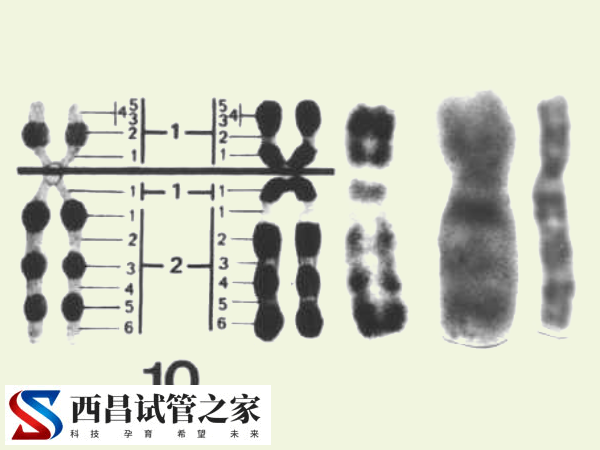 试管前为什么需要独自做染色体查看